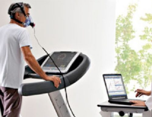 Τι είναι αερόβια ικανότητα;